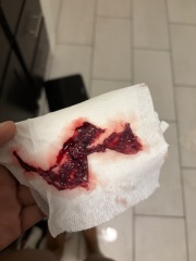 I think I may have had a miscarriage but am unsure [GRAPHIC PHOTOS ATTACHED]