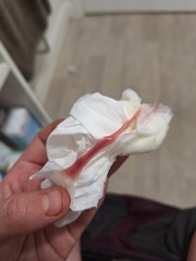 Could this be my mucus plug at 37 weeks pregnant?