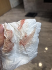 brown spotting when wiping, please help