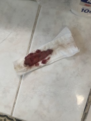 Bleeding at 7 weeks
