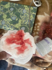 Bleeding at 7 weeks