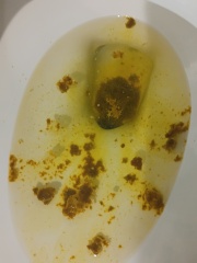TMI - poop pic included. Is this IBS or BAM?