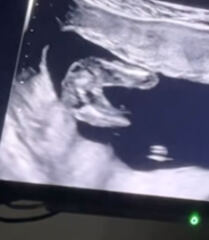 Girl or boy ?