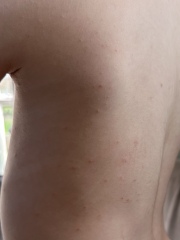Red itchy rash on son