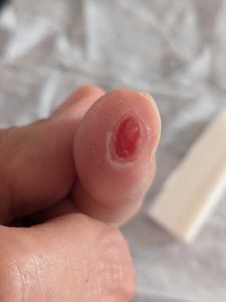 Gruesome (minor) accident