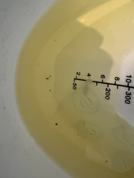Does this look like a spot of blood in my urine