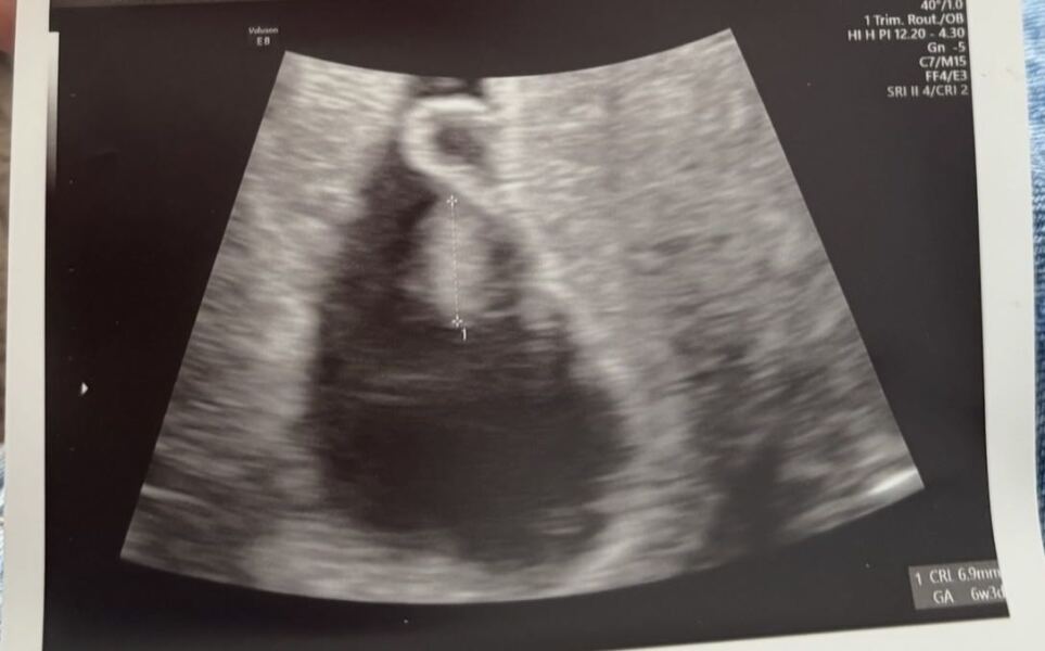 Scan dates/growth, please help