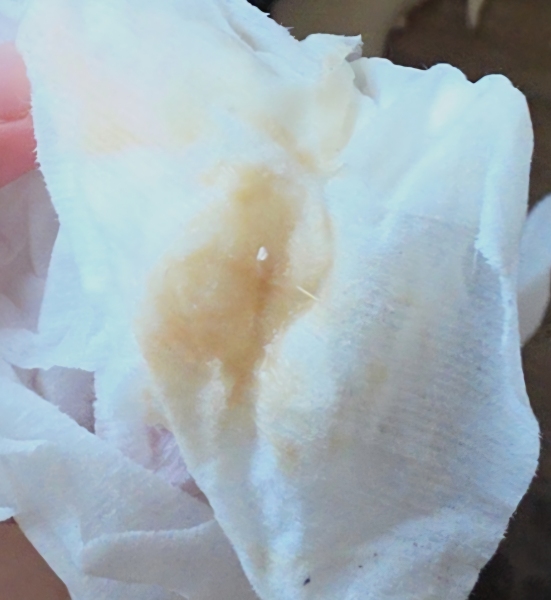 TMI SORRY! Brown-tinged discharge before ovulation, is this normal?