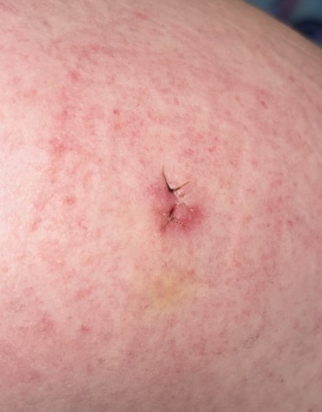 Could this be infected?