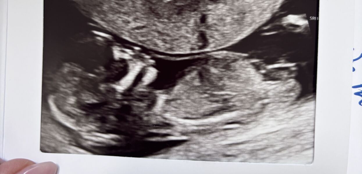 Girl or Boy?🤍