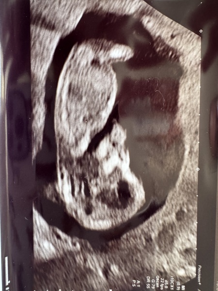Due Feb 2027