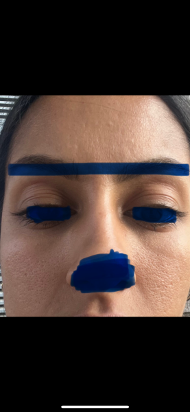 Dehydrated and textured skin, any anti-aging skincare tips