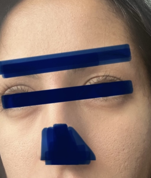 Dehydrated and textured skin, any anti-aging skincare tips