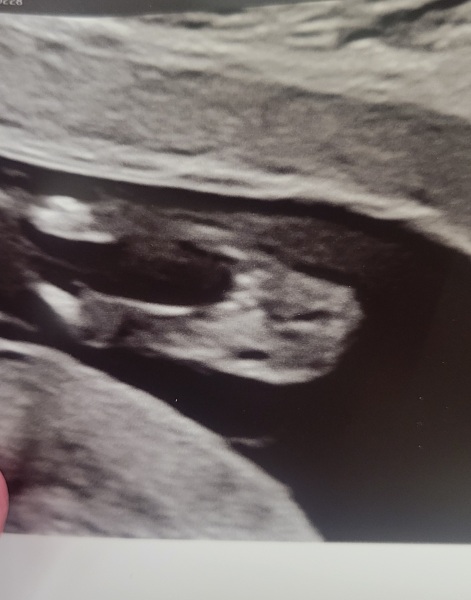 ❤️ Gender guesses please from this very clear potty shot ❤️
