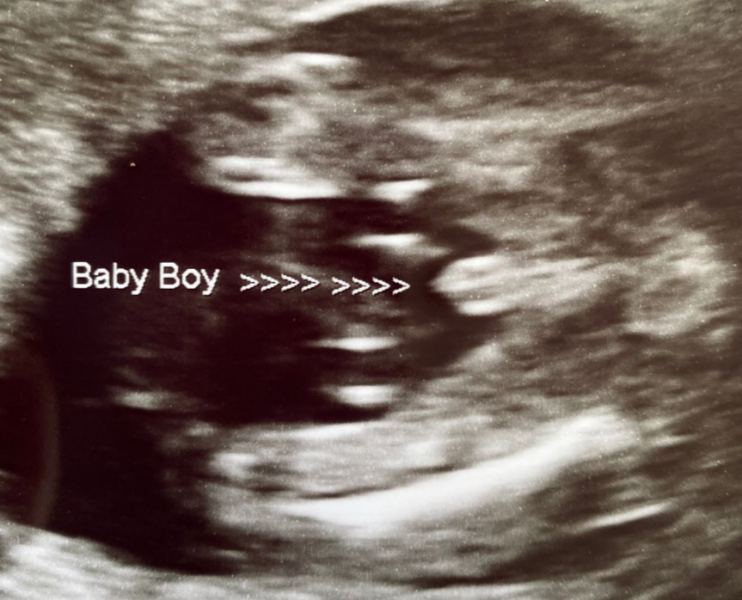 ❤️ Gender guesses please from this very clear potty shot ❤️