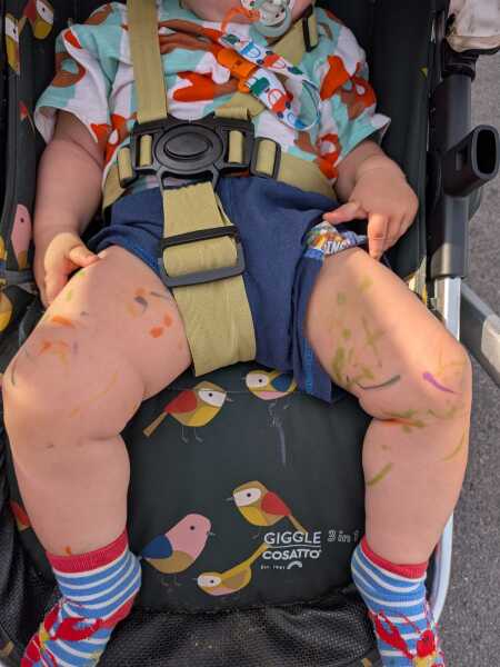Baby's skin covered in pen after nursery
