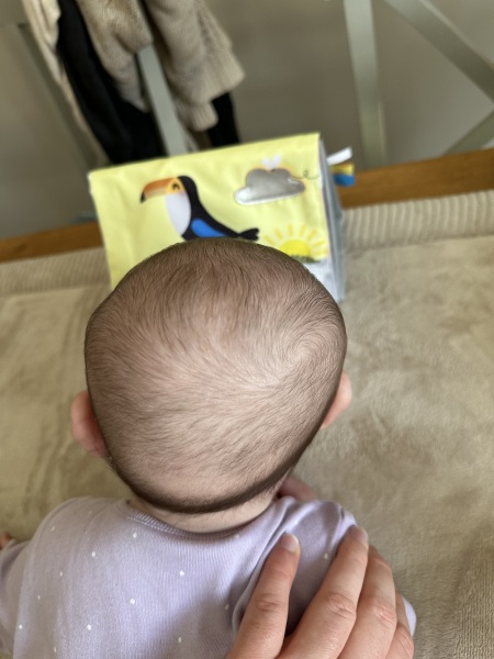 Baby flat spot on head