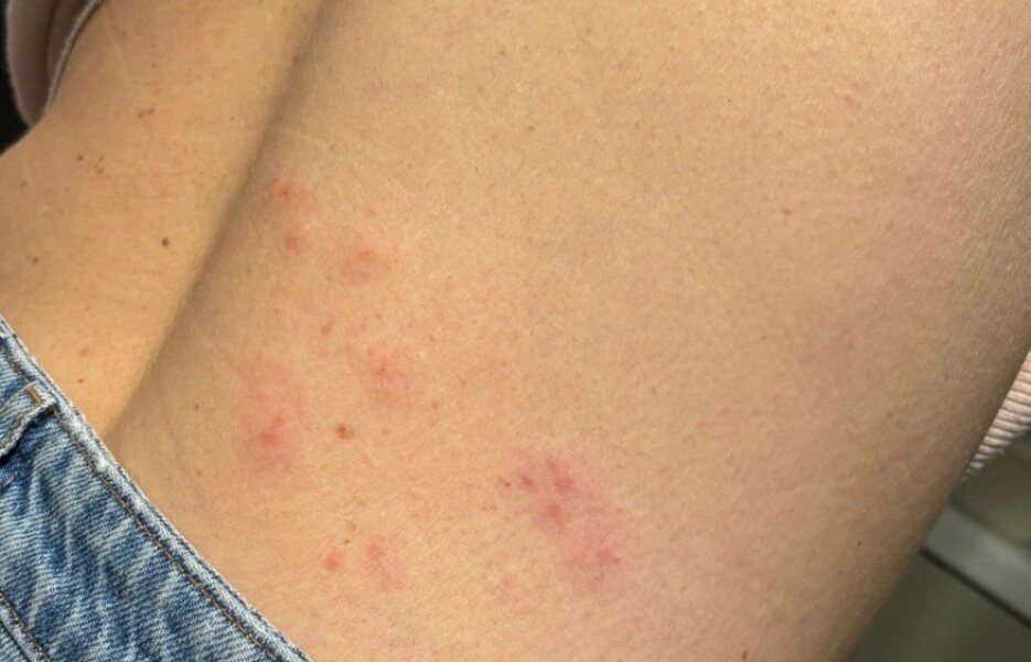 To not want to go back to the doctor for this?