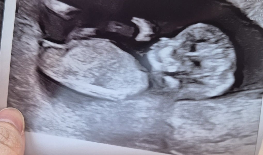 Girl or Boy?🤍