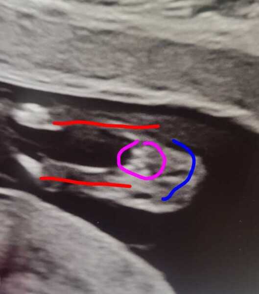 ❤️ Gender guesses please from this very clear potty shot ❤️