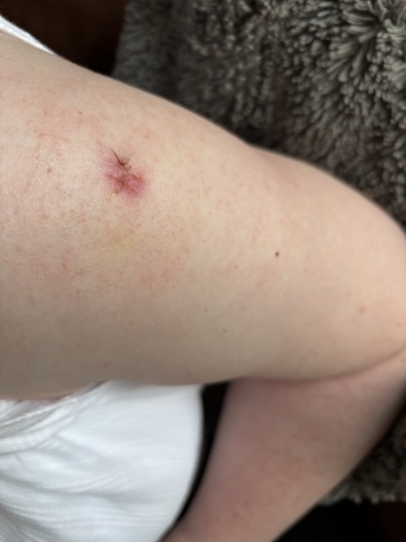 Could this be infected?