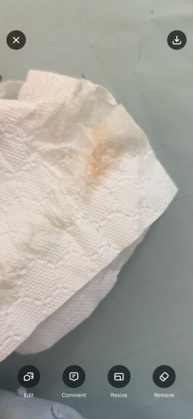 Implantation at 6-7dpo? Pics included