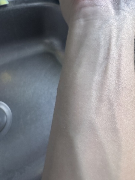 Cleaners, have you had forearm pain and tingling from scrubbing?