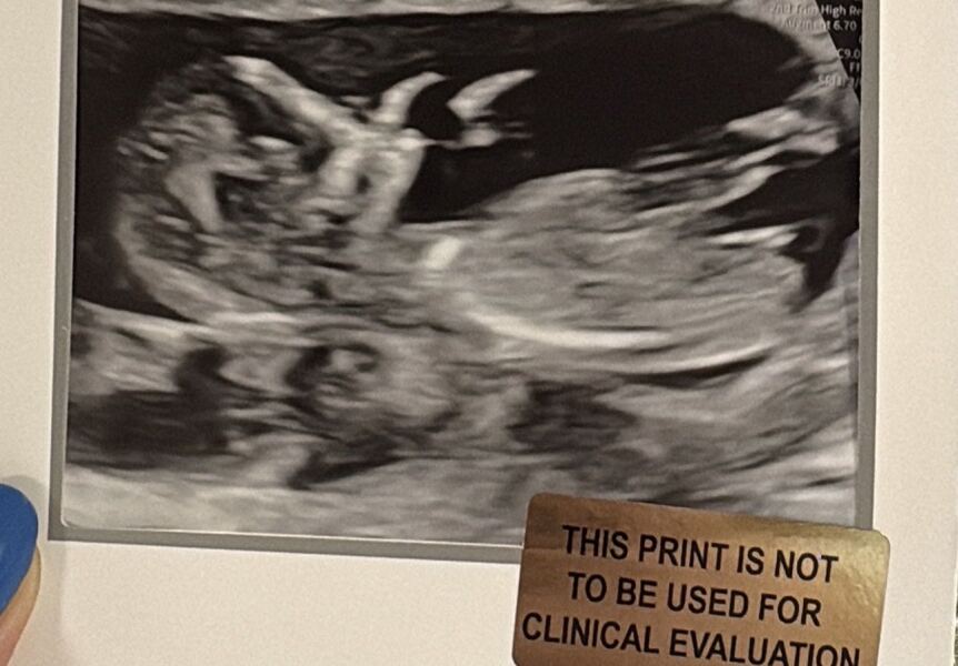 Boy or girl?