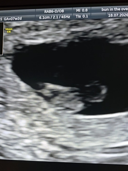 Due March 2027