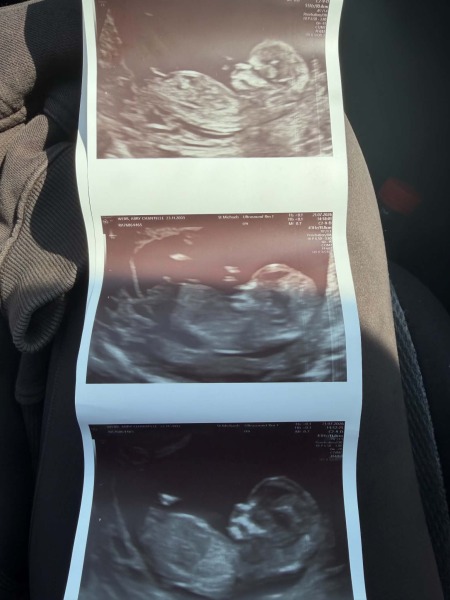 12 + 2 scan, any guesses on sex of the baby?