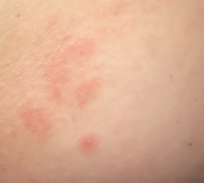 To not want to go back to the doctor for this?