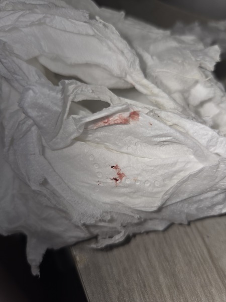 Pregnancy uti cause small clot pic attached