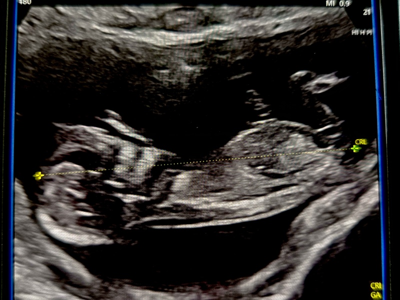 Gender guesses 😊
