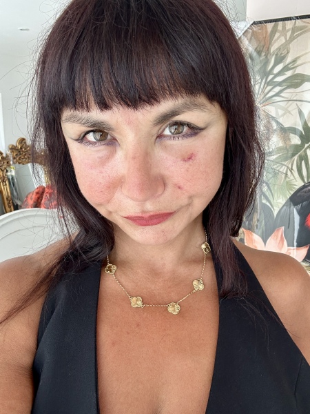 Is it normal to feel guilty before a planned facelift?