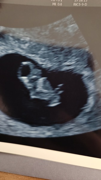 Due March 2027