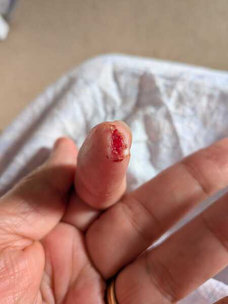 Gruesome (minor) accident