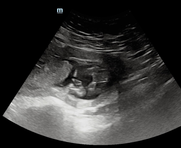 Gender scan