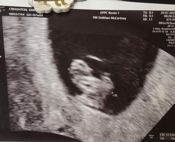 Ramzi guesses 7 weeks