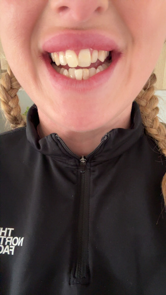 To really despise my teeth!!