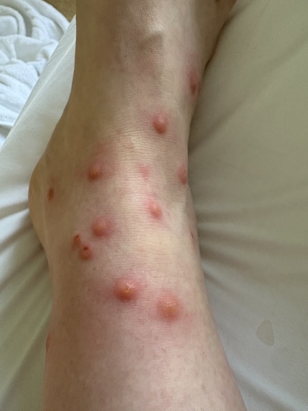 Holiday cottage- possible flea infestation