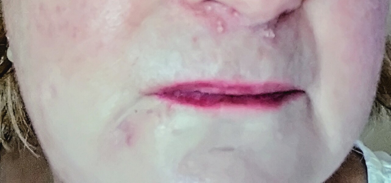 Are these spots due to menopause?
