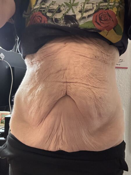 Weight loss mess.