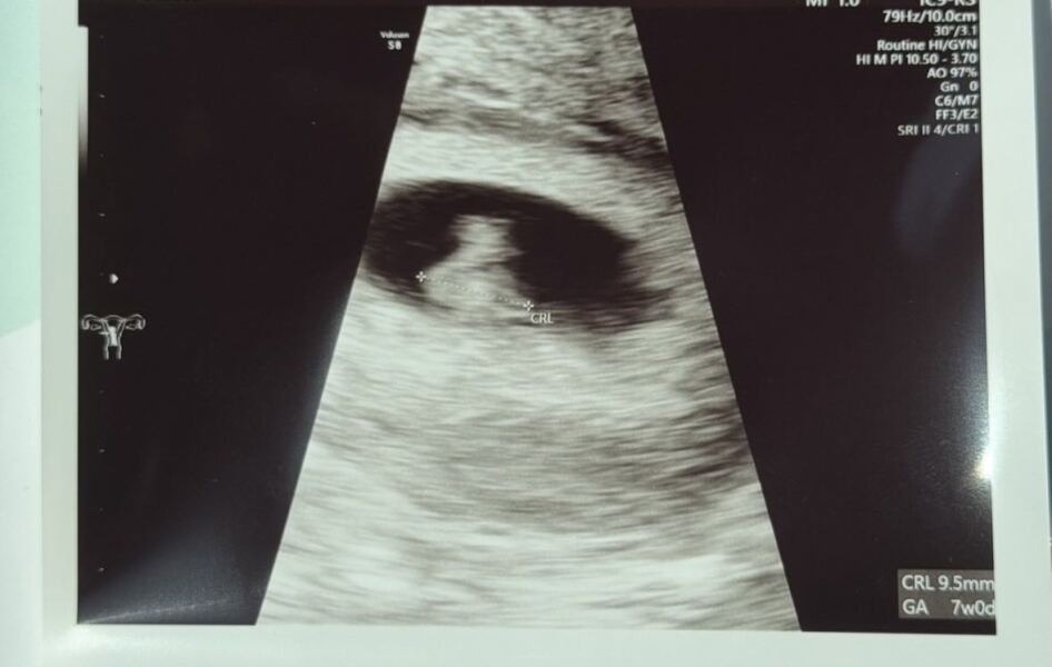June IVF/FET 👶 🌟 ❤️