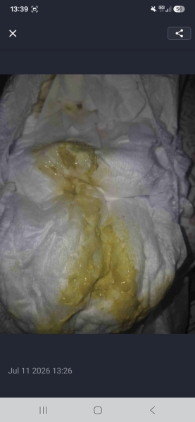 CMPA query *[Content warning: nappy pics included]