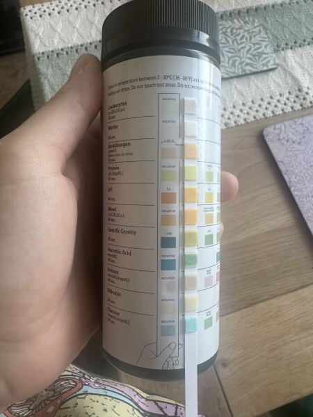 Dd urine stick large specific gravity ?