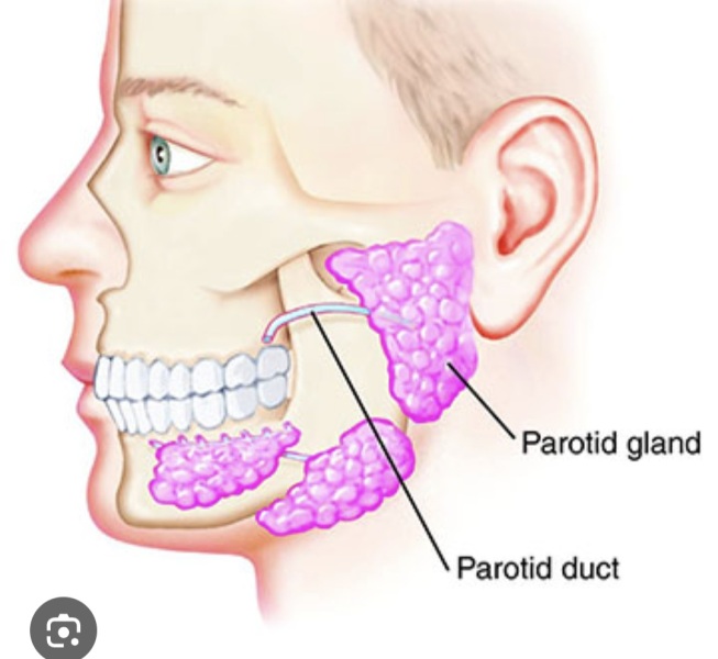 Salivary gland stone/blockage