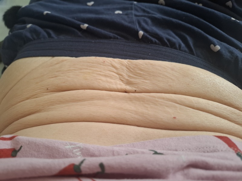 Weight loss mess.