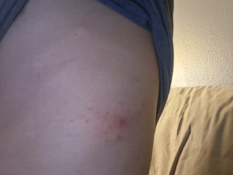 Worried about lump under armpit?