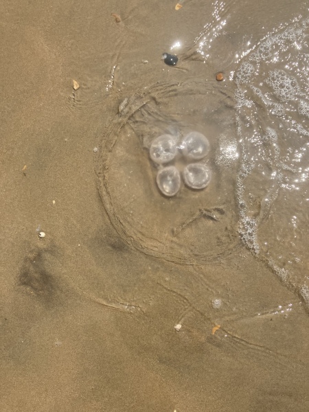 Jellyfish sting
