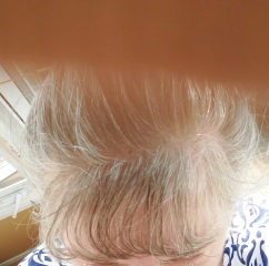 Considering subtle hair colour for thin, once darkish  blonde hair